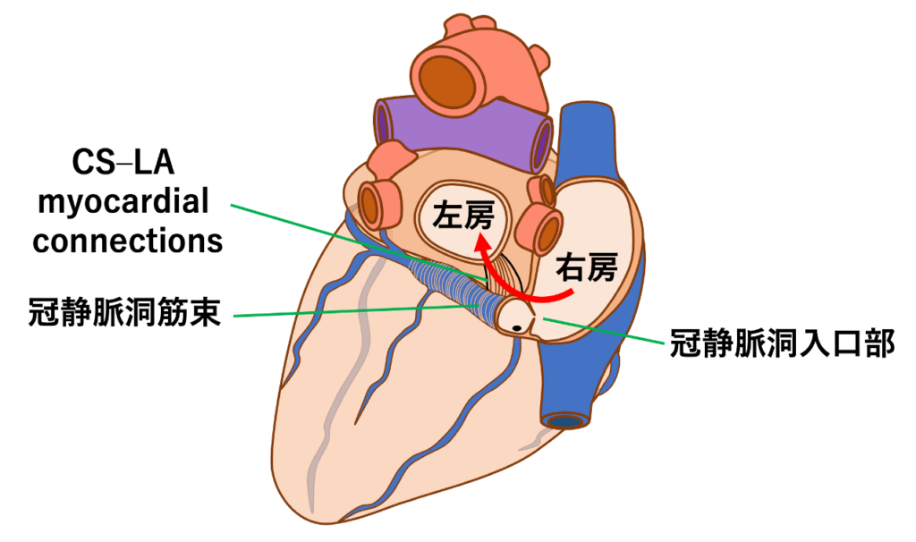 冠静脈洞筋束
右房心筋は冠静脈洞筋束を介して左房心筋へと興奮を伝導することができます。これは右房と左房を電気的につなぐ心房間伝導路の一つです(inferior interatrial connection)。右房心筋→冠静脈洞入口部→冠静脈洞筋束が連続しており、さらに途中で冠静脈洞筋束→bridging myocardial fibers→左房心筋という連続性があることが報告されています。