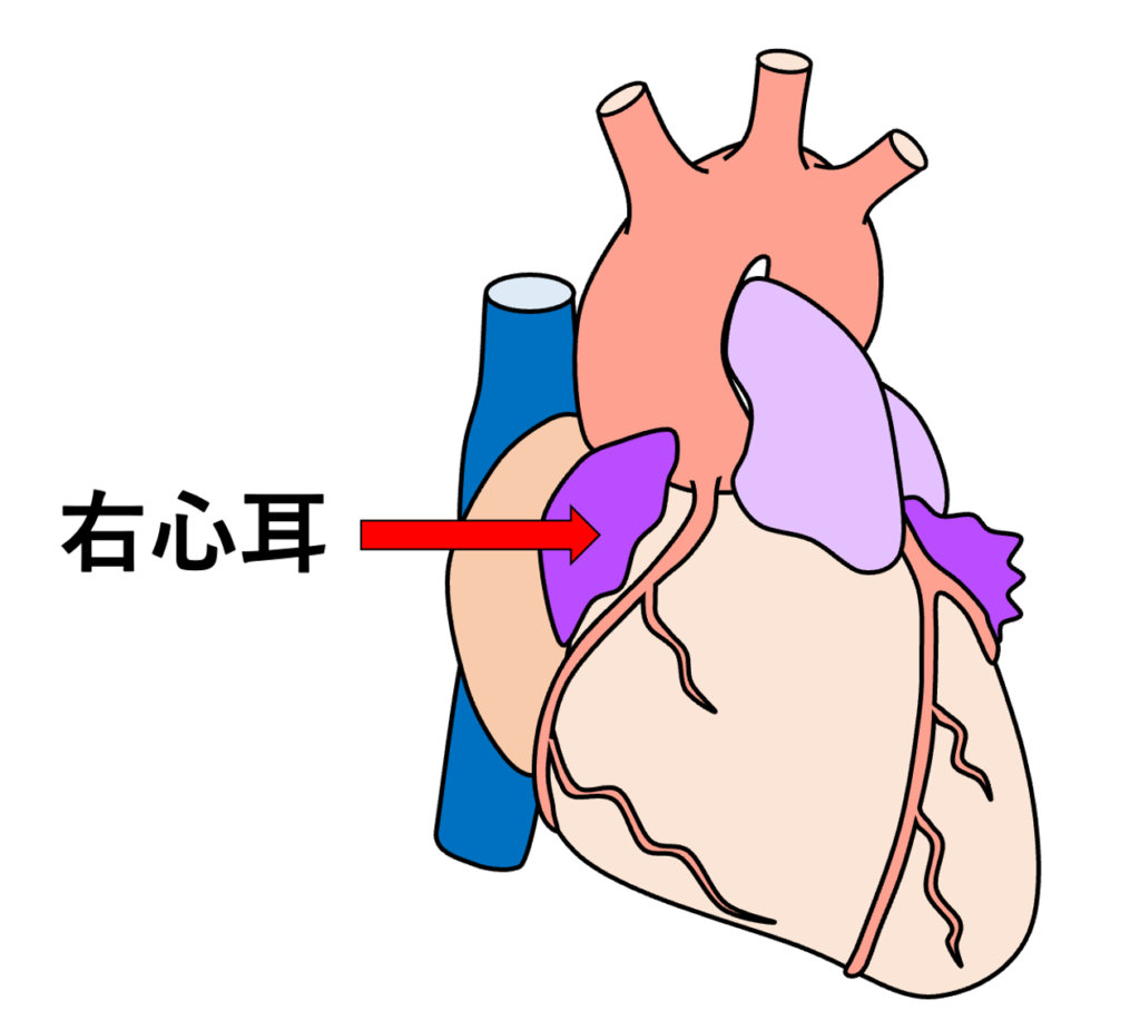 右心耳(right atrial appendage)
右心耳とは、右心房の前方から前上方へ突出する袋状の構造です。「心耳」という名前は外観が耳のように見えることに由来します。