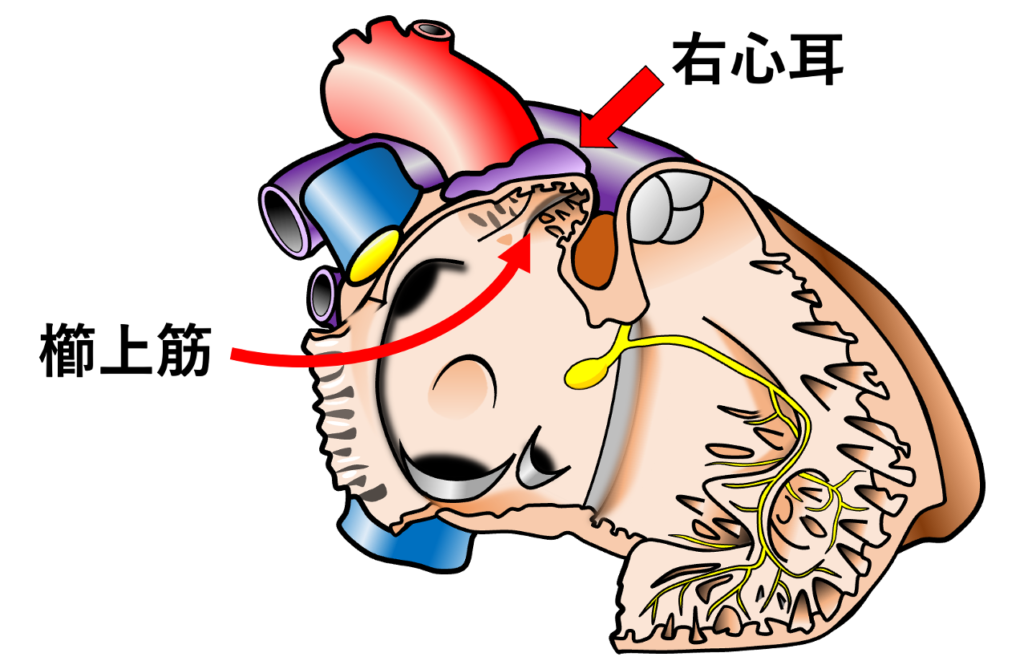 右心耳(right atrial appendage)
右心房の本体と連続していますが、内部には櫛状筋(pectinate muscles)と呼ばれる筋肉の隆起が発達しているのが特徴です。右心房内では分界稜(crista terminalis)が、後方の平滑な静脈洞部と、前方の櫛状筋を有する領域との境界となっています1)。
