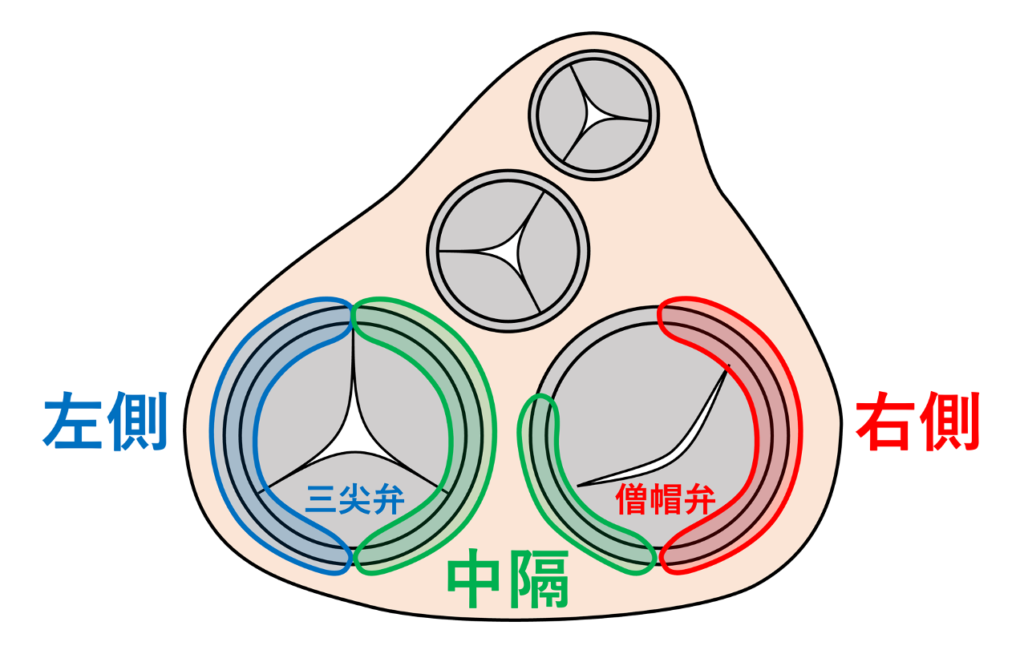 ケント束(Kent bundle)
ケント束は胎生期に存在する心房筋と心室筋の筋性連続が発生過程で完全に消失せず残存したものと考えられています。主に僧帽弁輪や三尖弁輪に沿って分布し、左側、右側、中隔側などに分類されます。
