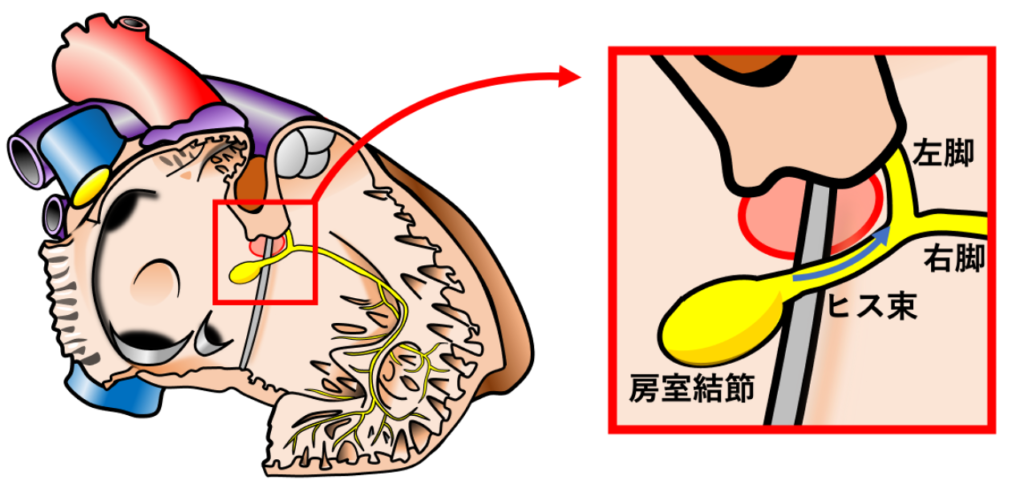膜性中隔(membranous septum)
膜性中隔は刺激伝導系との関係においても重要です。房室結節から続くヒス束は中心線維体を貫通し、膜性中隔の下縁付近を走行します。その後、筋性心室中隔の上部で右脚と左脚に分岐します。