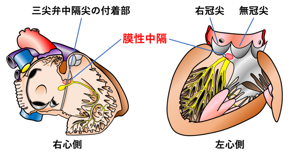 膜性中隔(membranous septum)
膜性中隔は心室中隔の基部に位置し、大動脈弁の右冠尖と無冠尖の交連直下、三尖弁中隔尖の付着部付近に存在します。