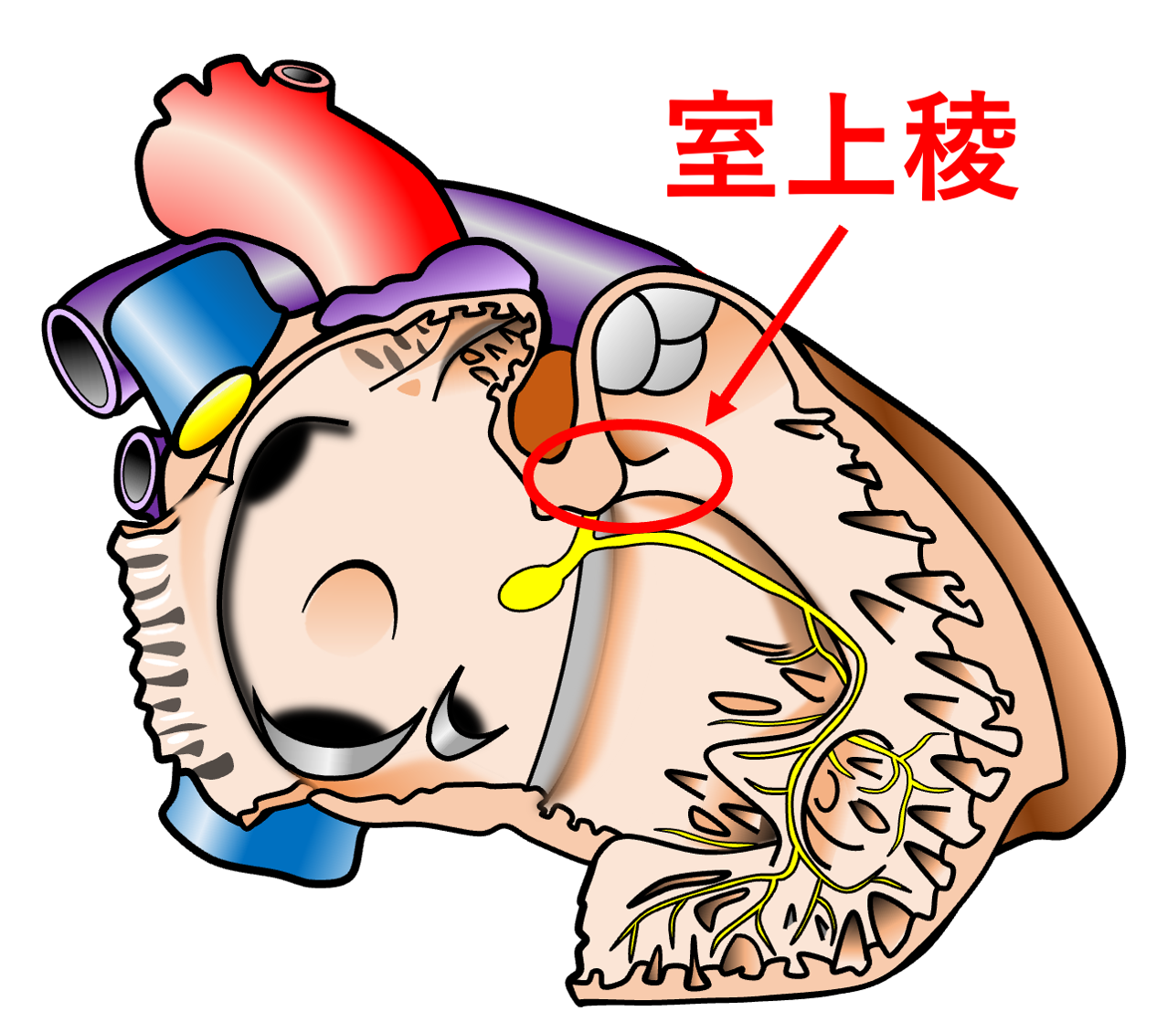 室上稜(supraventricular crest)