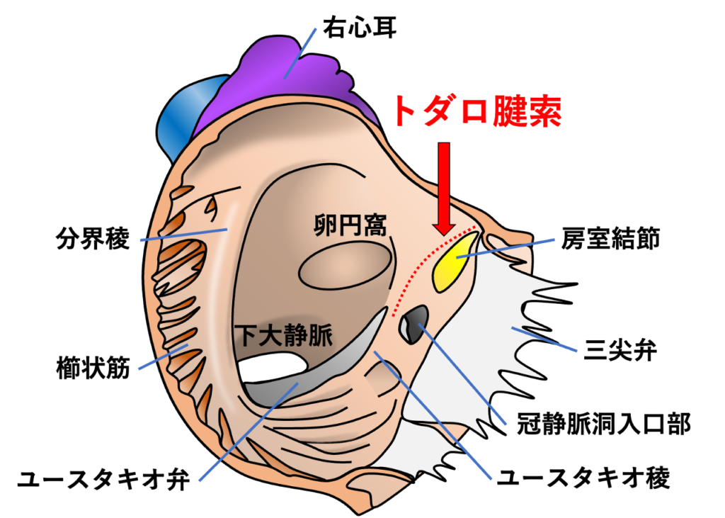 トダロ腱索(tendon of Todaro)
トダロ腱索とは、右心房内に存在する線維性の索状構造であり房室結節の位置を推定するうえで重要な解剖学的指標です。下大静脈入口部に存在するユースタキオ弁(下大静脈弁)の線維性延長として形成され、心房中隔側を前上方へ走行して中心線維体(central fibrous body)付近に至ります。通常、心内膜下を走行するため肉眼的に明瞭な索状構造として確認できるわけではありません。トダロ索はユースタキオ稜(Eustachian ridge)と解剖学的に連続していますが、トダロ腱索は線維性の索状構造、ユースタキオ稜は右房内面の隆起を指し、厳密には異なる構造です。