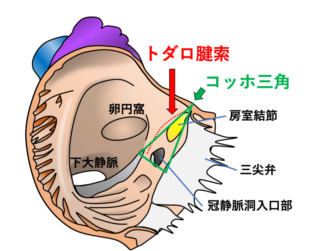 トダロ腱索(tendon of Todaro)
トダロ索はコッホ三角(triangle of Koch)を構成する重要な境界の一つです。コッホ三角は、トダロ索、三尖弁中隔尖の付着部、冠静脈洞入口部によって囲まれる領域であり、その前上方の頂点付近に房室結節が存在します。房室結節から連続するHis束は中心線維体を貫いて心室側へ走行します。トダロ索自体は特殊伝導系ではなく、主として線維性組織から構成されるため電気的興奮の伝導には直接関与しません。